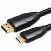 Кабель HDMI Vention VAA-D02-B150 1,5 m Чёрный