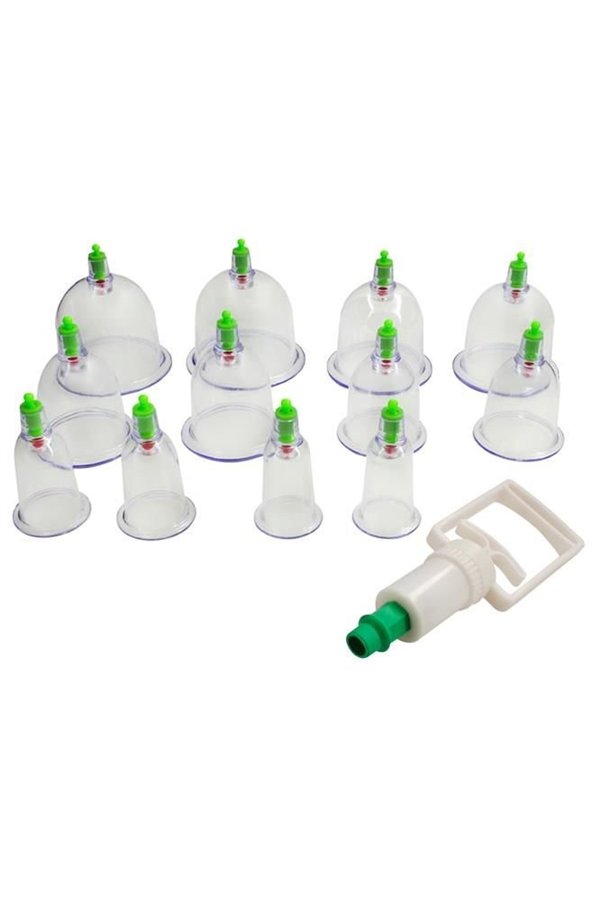 Chinese vacuum cupping