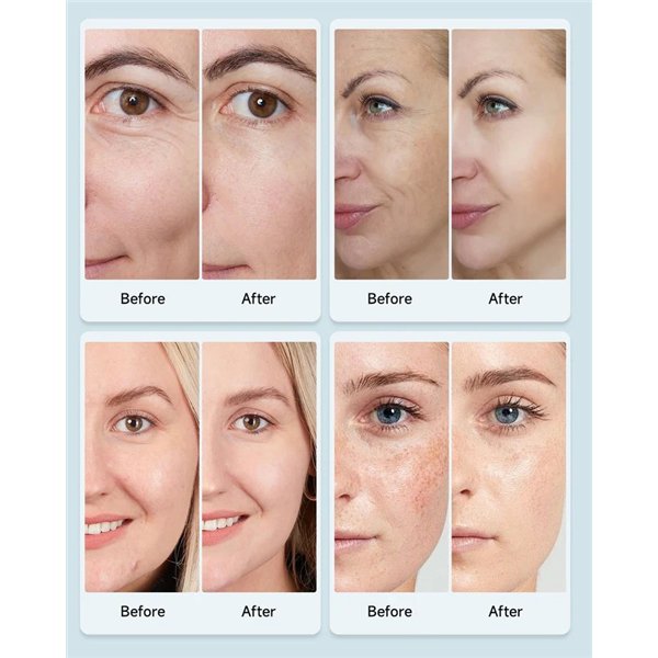 LED face mask Reach FC1